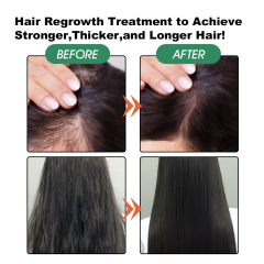 Pure Batana Oil Hair Growth Organics Natural Hair Growth Oil Conditioner That Nourishes Damaged Hair,oalen cosmetics