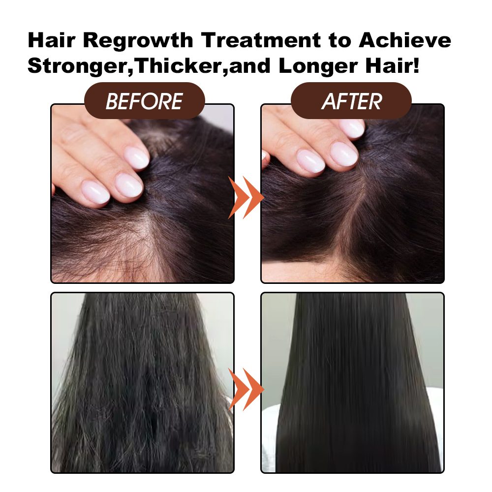 Batana Pure Natural Hair Growth Oil Nourishes Scalp Eliminates Split Ends Reduces Hair Fall Anti-Dandruff for All Hair Types,oalen cosmetics