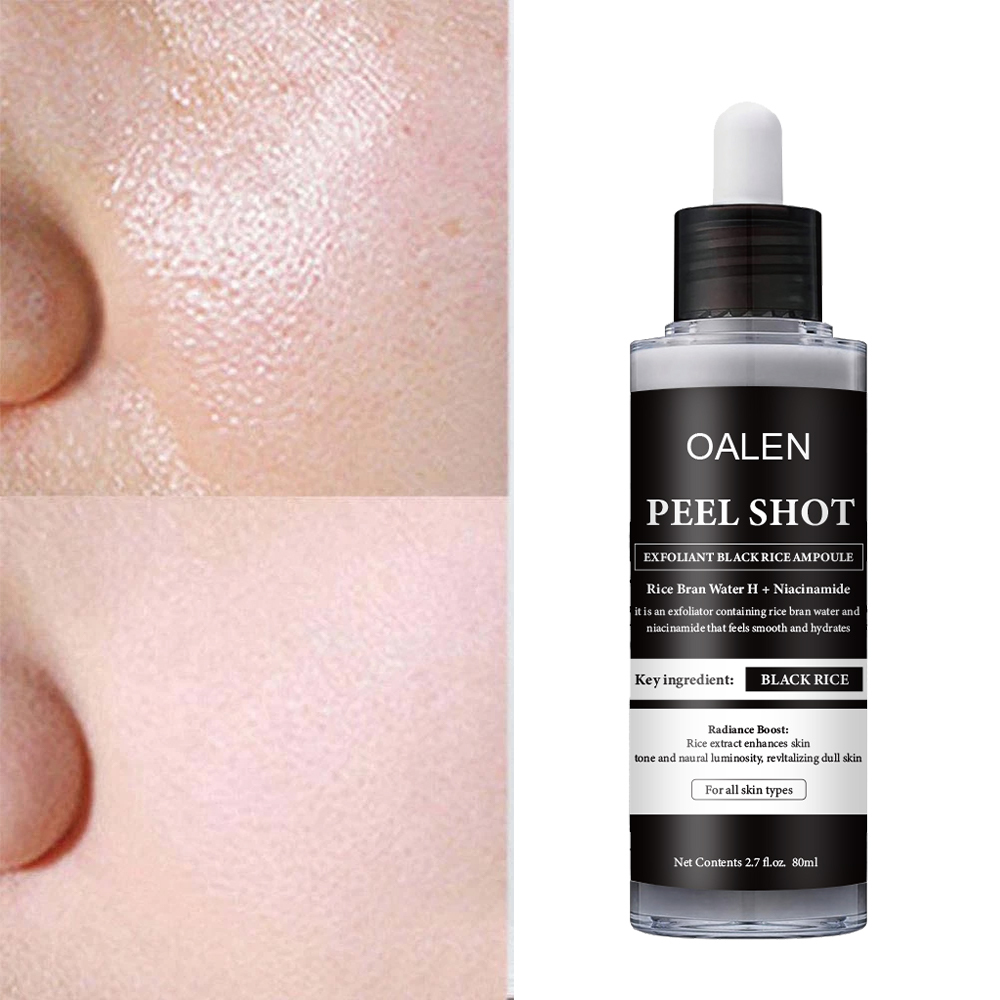 Luxfume Private Label Exfoliating Black Rice Serum Smooth and Glowing Skin Care Peel Off Serum,oalen cosmetics