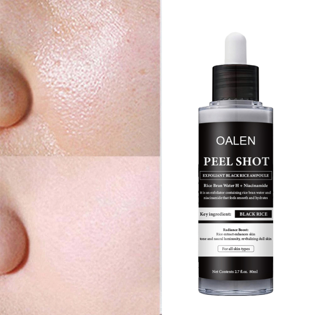 Luxfume Private Label Exfoliating Black Rice Serum Smooth and Glowing Skin Care Peel Off Serum,oalen cosmetics