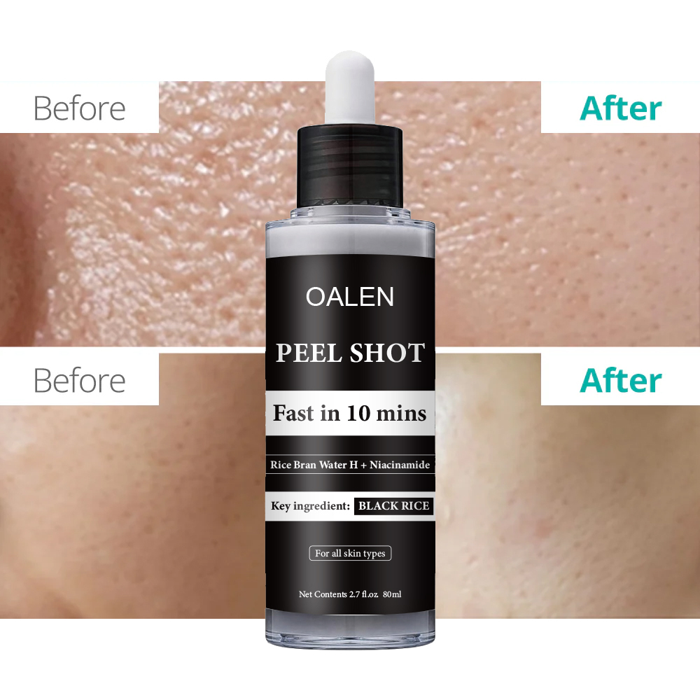 Luxfume Private Label Exfoliating Black Rice Serum Smooth and Glowing Skin Care Peel Off Serum,oalen cosmetics