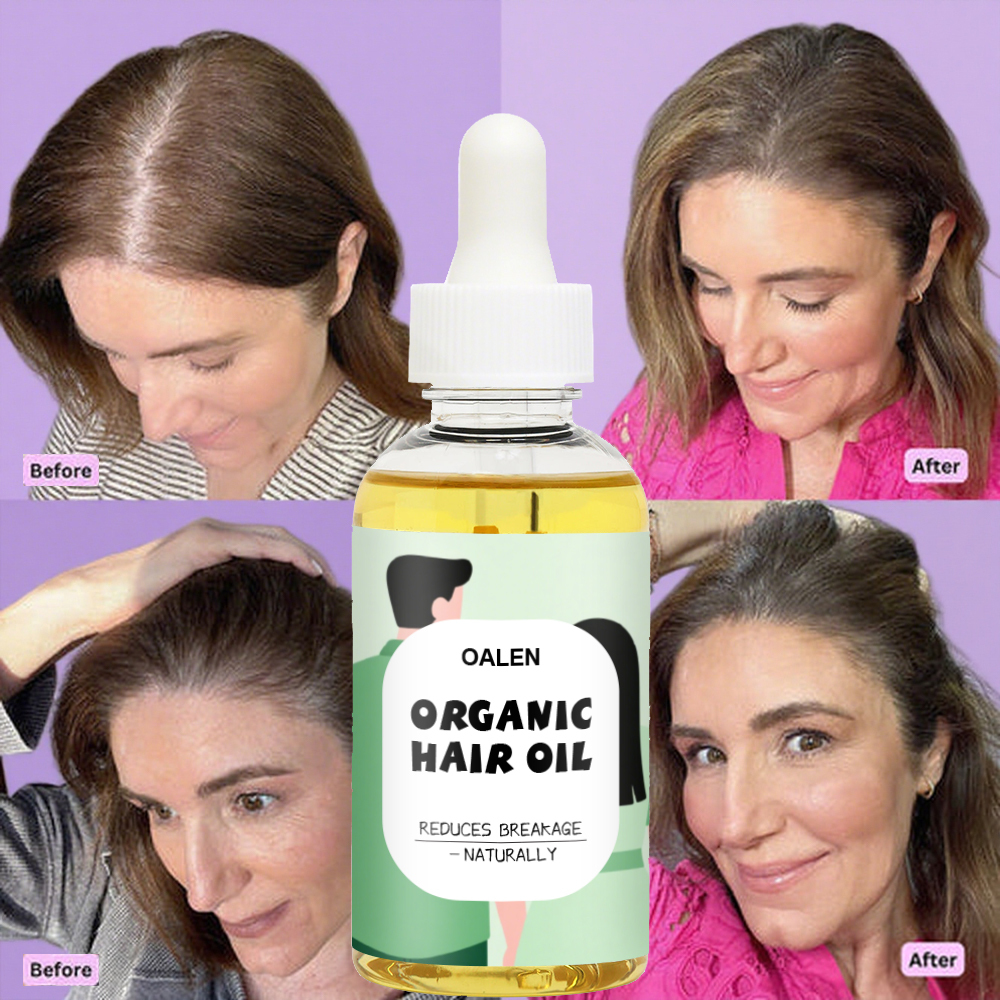 Organic Naturally Rosemary Oil Hair Growth Serum Natural Anti-Hair Loss Treatment Argan Oil Wholesale Quick Hair Growth Oil,oalen cosmetics