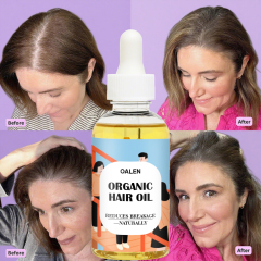 Private Label 100% Organic Vegan Scalp Nourishing Hair Oil Rosemary Infused Anti-Dandruff Anti-Hair Loss Growth Protection Serum,MY SHOP