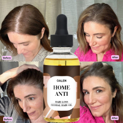 30ML HAIR GROWTH ELIXIR Private Label 100% Natural Home Anti Hair Oil Loss Treatment Fast Regrowth Herbal Hair Oils,MY SHOP