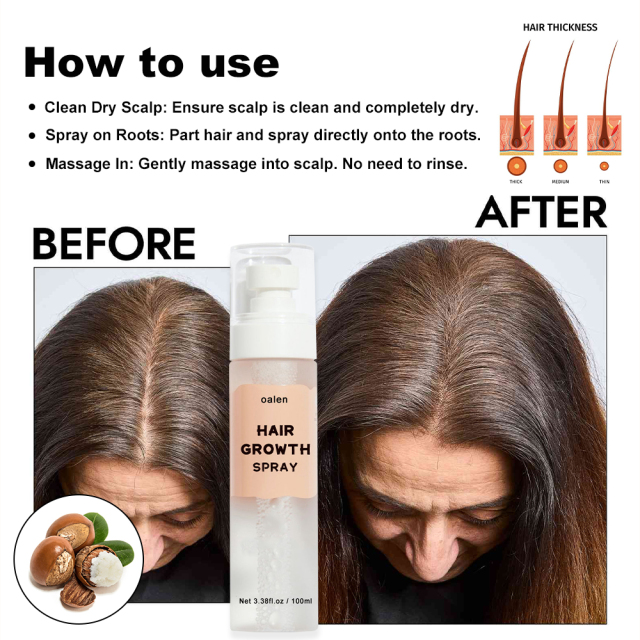 Herbal Hair Growth Serum Spray Hair Care Leave in Oil Free Lightweight Absorbs Quickly Biotin Rosemary Hair Growth Spray,oalen cosmetics