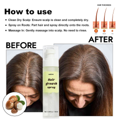 Luxfume Herbal Hair Growth Sprays for Men and Women Fast Scalp Regrowth Oil Treatment Beauty Health Product,oalen cosmetics