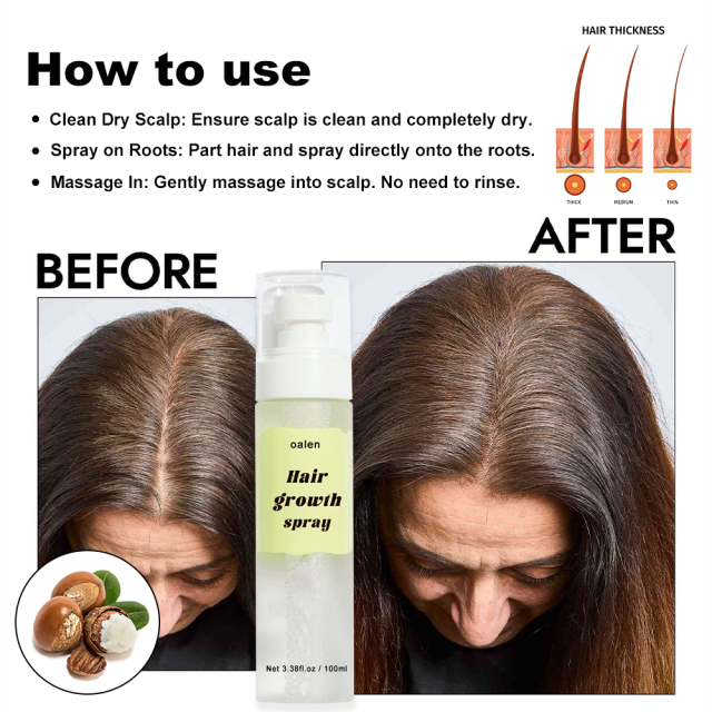 Luxfume Herbal Hair Growth Sprays for Men and Women Fast Scalp Regrowth Oil Treatment Beauty Health Product,oalen cosmetics