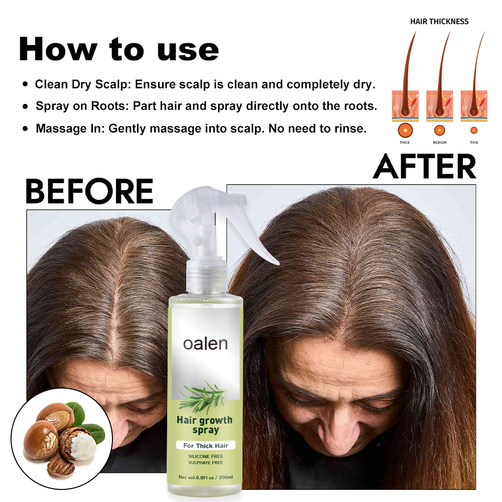 Nourishes Roots for Thicker Hair Growth Sprays for Men and Women Fast Scalp Regrowth Oil Treatment Beauty Health Product,oalen cosmetics