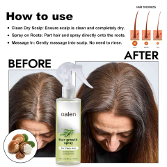 Nourishes Roots for Thicker Hair Growth Sprays for Men and Women Fast Scalp Regrowth Oil Treatment Beauty Health Product,oalen cosmetics