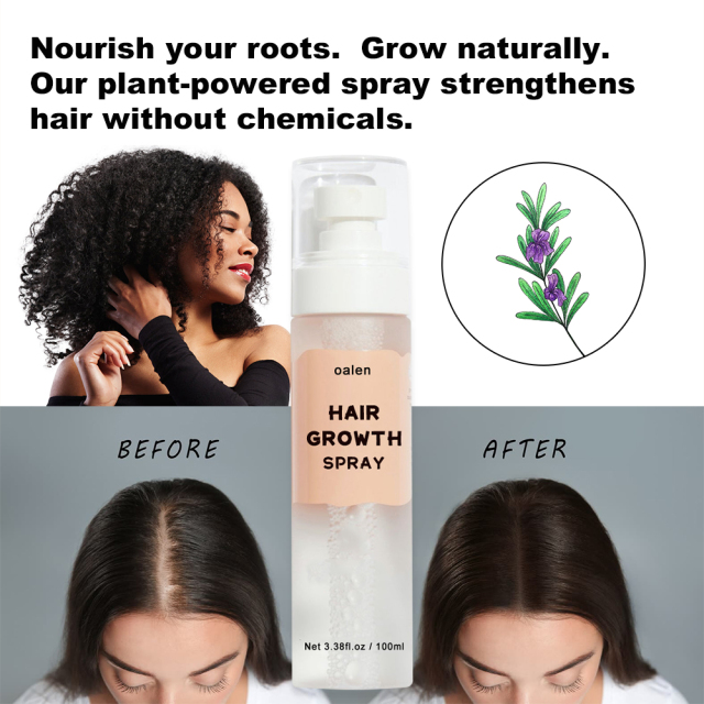 Herbal Hair Growth Serum Spray Hair Care Leave in Oil Free Lightweight Absorbs Quickly Biotin Rosemary Hair Growth Spray,oalen cosmetics