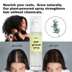 Luxfume Herbal Hair Growth Sprays for Men and Women Fast Scalp Regrowth Oil Treatment Beauty Health Product,oalen cosmetics