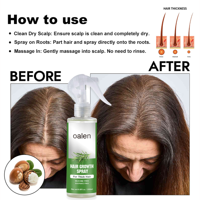 Hair Loss Regrowth Treatments 100ml Hair Growth Liquid Scalp Spray Serum New Bunee Hair Lotion Health Product,oalen cosmetics