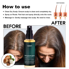 Hot Sale Hair Care Oalen Hair Spray Grow Moisturizing Strong Organic Oalen Hair Growth Spray,MY SHOP