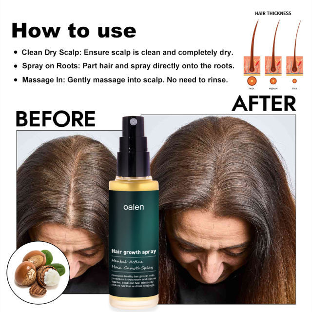 Hot Sale Hair Care Oalen Hair Spray Grow Moisturizing Strong Organic Oalen Hair Growth Spray,MY SHOP