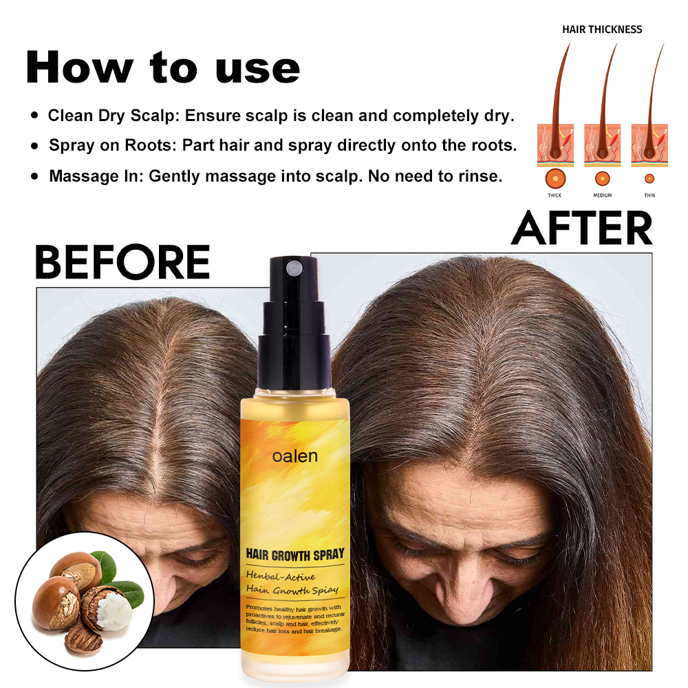 Daily Use Herbal Ginger Paraben Fee Normal Looking Spray Anti Hair Loss Lotion Tonic Biotin Hair Growth Spray,MY SHOP