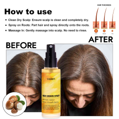 Daily Use Herbal Ginger Paraben Fee Normal Looking Spray Anti Hair Loss Lotion Tonic Biotin Hair Growth Spray,MY SHOP