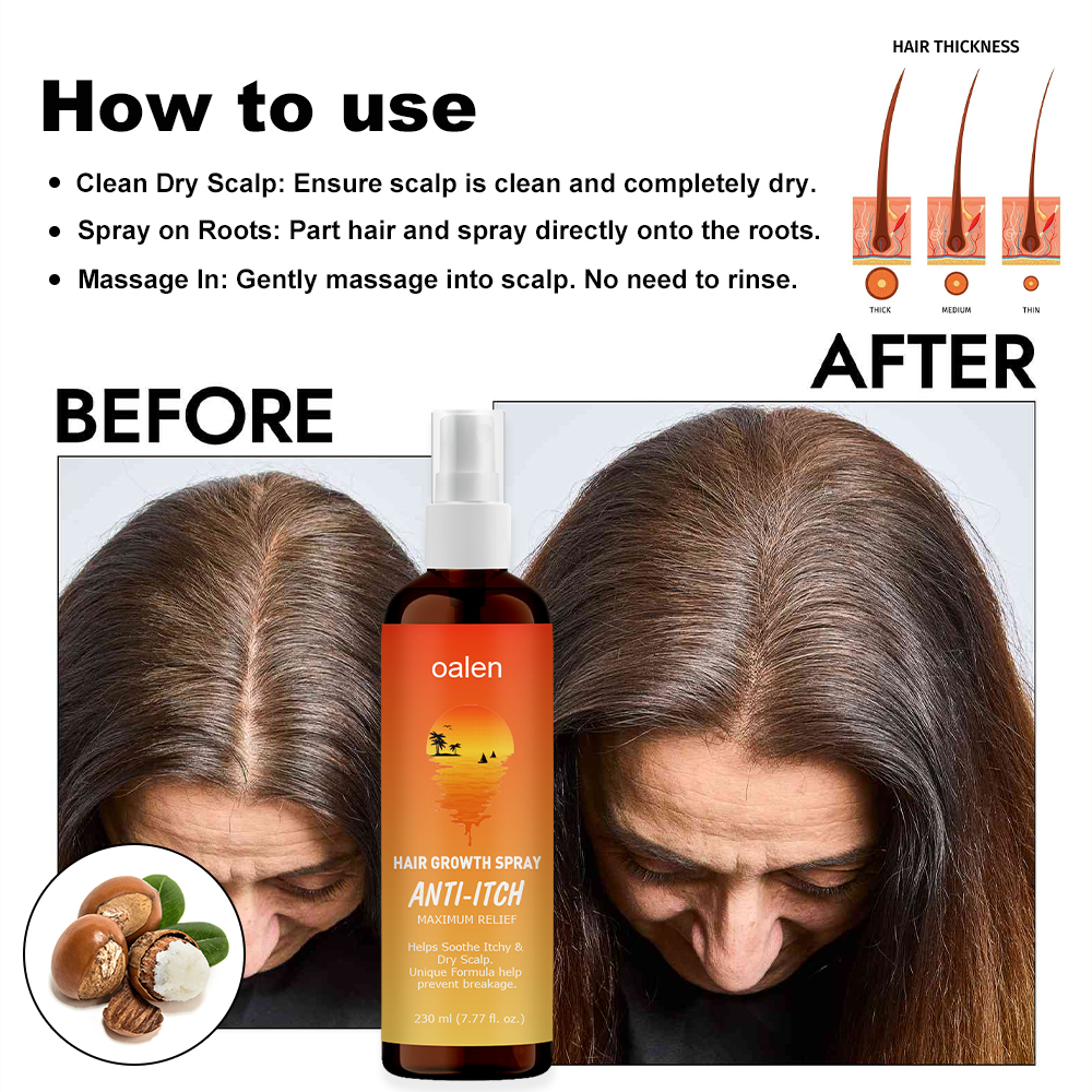 Hair Growth Spray Hair Loss Regrowth Treatments Hair Growth Liquid Scalp Spray Serum New Bunee Hair Lotion,oalen cosmetics