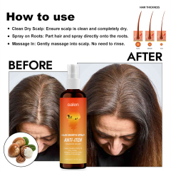 Hair Growth Spray Hair Loss Regrowth Treatments Hair Growth Liquid Scalp Spray Serum New Bunee Hair Lotion,oalen cosmetics