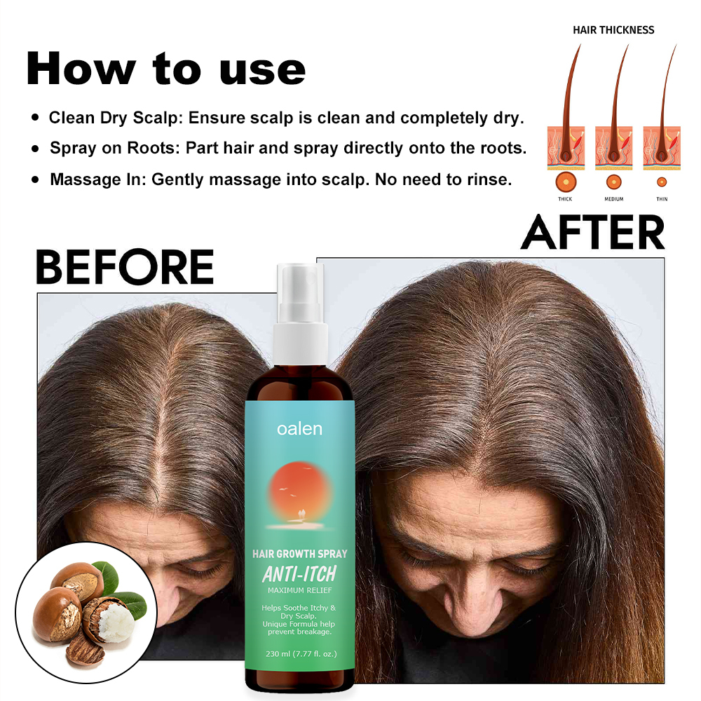 New Bunee Hair Lotion Hair Growth Spray Hair Loss Regrowth Treatments Hair Growth Liquid Scalp Spray Serum,oalen cosmetics
