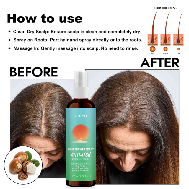 New Bunee Hair Lotion Hair Growth Spray Hair Loss Regrowth Treatments Hair Growth Liquid Scalp Spray Serum,oalen cosmetics