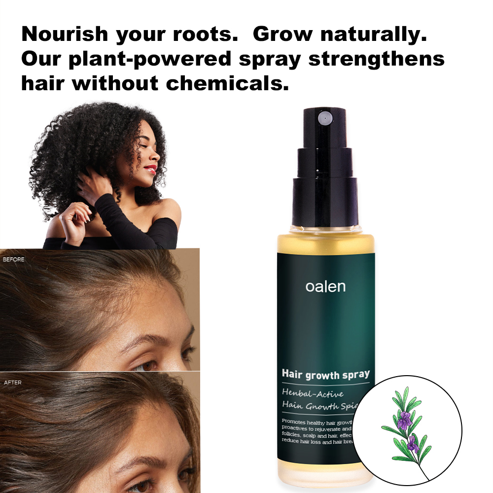 Hot Sale Hair Care Oalen Hair Spray Grow Moisturizing Strong Organic Oalen Hair Growth Spray,MY SHOP