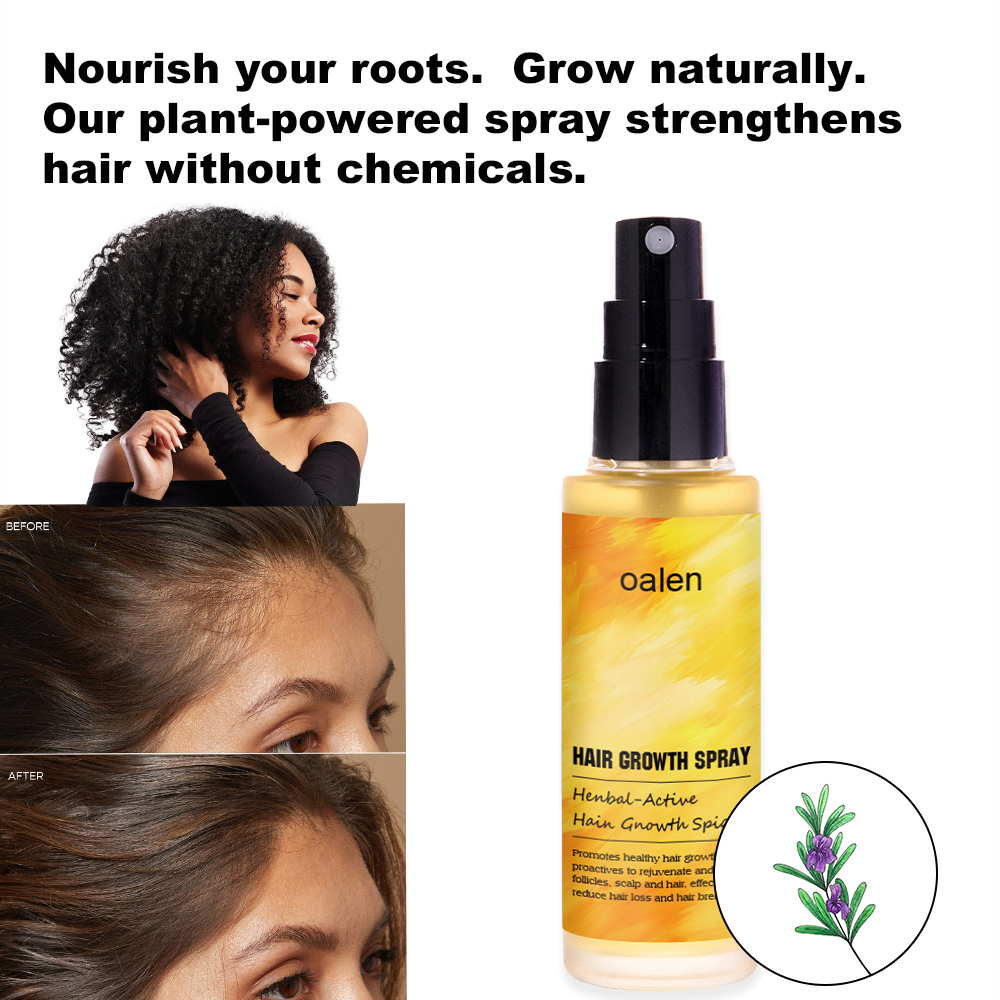 Daily Use Herbal Ginger Paraben Fee Normal Looking Spray Anti Hair Loss Lotion Tonic Biotin Hair Growth Spray,MY SHOP