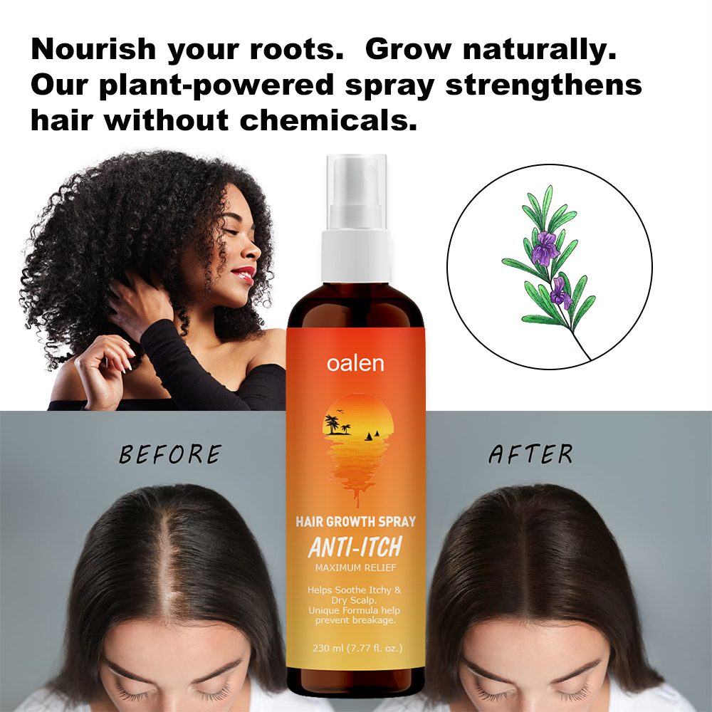 Hair Growth Spray Hair Loss Regrowth Treatments Hair Growth Liquid Scalp Spray Serum New Bunee Hair Lotion,oalen cosmetics