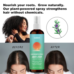 New Bunee Hair Lotion Hair Growth Spray Hair Loss Regrowth Treatments Hair Growth Liquid Scalp Spray Serum,oalen cosmetics