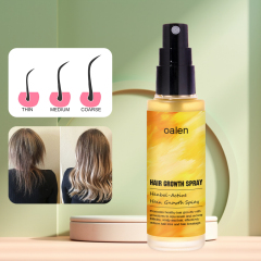 Daily Use Herbal Ginger Paraben Fee Normal Looking Spray Anti Hair Loss Lotion Tonic Biotin Hair Growth Spray,MY SHOP