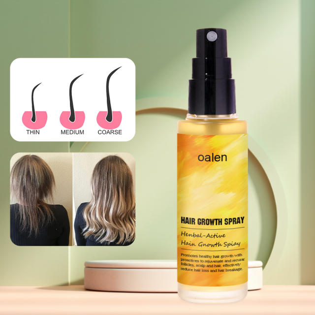 Daily Use Herbal Ginger Paraben Fee Normal Looking Spray Anti Hair Loss Lotion Tonic Biotin Hair Growth Spray,MY SHOP