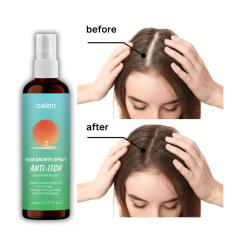 New Bunee Hair Lotion Hair Growth Spray Hair Loss Regrowth Treatments Hair Growth Liquid Scalp Spray Serum,oalen cosmetics