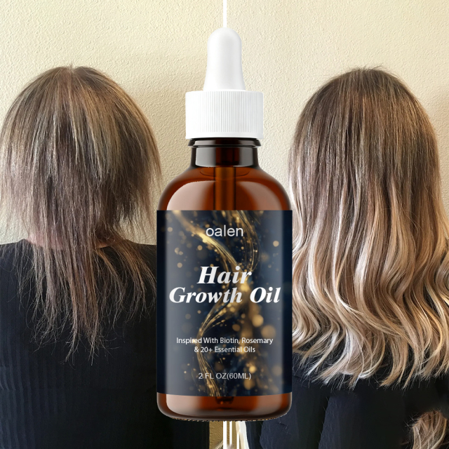 Women's Hair Growth Oil Veganic Natural Keratin Treatment with Rosemary Essential Oils Fast Hair for Serum,MY SHOP