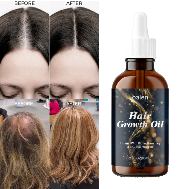 Women's Hair Growth Oil Veganic Natural Keratin Treatment with Rosemary Essential Oils Fast Hair for Serum,MY SHOP