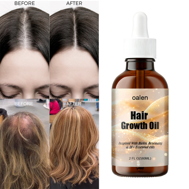 60ML Hair Growth Oil Veganic Natural Keratin Treatment with Rosemary Essential Oils Fast Hair for Serum,oalen cosmetics