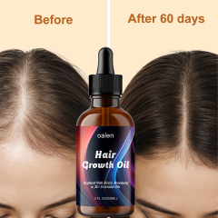 OEM Natural Herbal Rosemary Castor Anti-hair Loss Hair Lotion Pure Plant Scalp Treatment Essential Oil Hair Growth Oil,oalen cosmetics