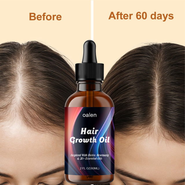 OEM Natural Herbal Rosemary Castor Anti-hair Loss Hair Lotion Pure Plant Scalp Treatment Essential Oil Hair Growth Oil,oalen cosmetics
