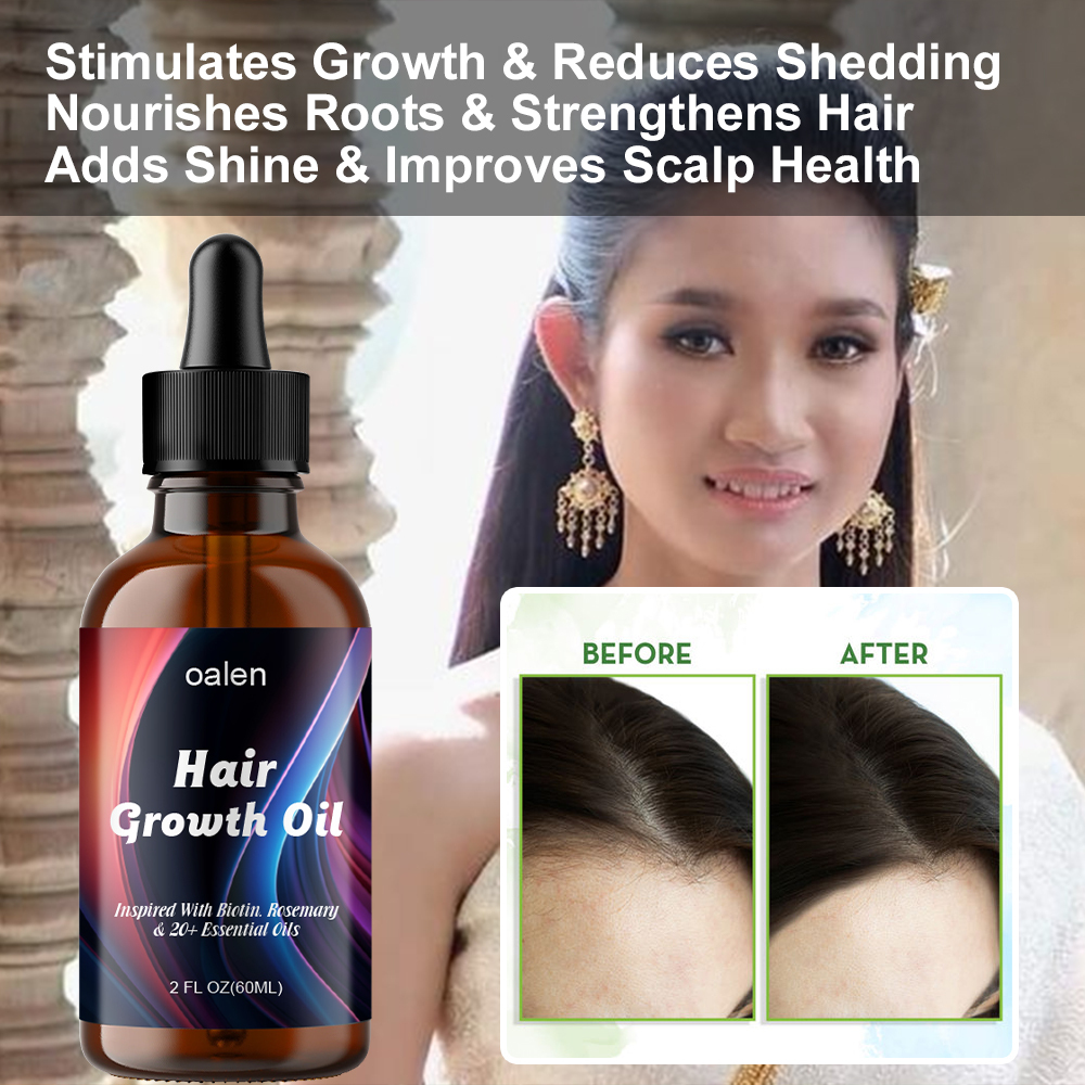 OEM Natural Herbal Rosemary Castor Anti-hair Loss Hair Lotion Pure Plant Scalp Treatment Essential Oil Hair Growth Oil,oalen cosmetics