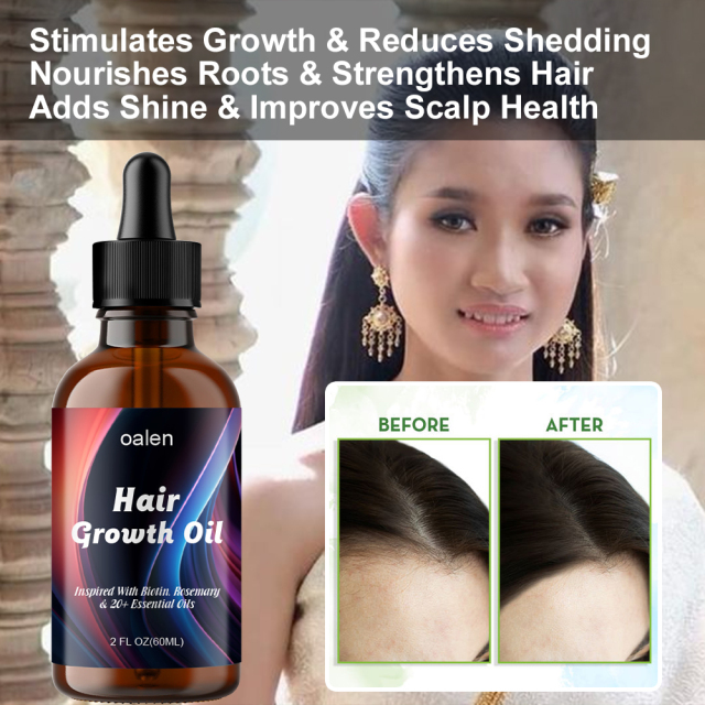 OEM Natural Herbal Rosemary Castor Anti-hair Loss Hair Lotion Pure Plant Scalp Treatment Essential Oil Hair Growth Oil,oalen cosmetics