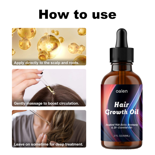 OEM Natural Herbal Rosemary Castor Anti-hair Loss Hair Lotion Pure Plant Scalp Treatment Essential Oil Hair Growth Oil,oalen cosmetics
