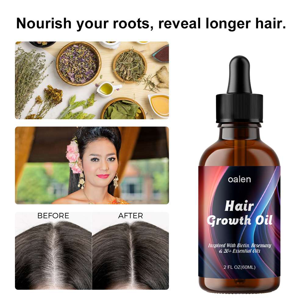 OEM Natural Herbal Rosemary Castor Anti-hair Loss Hair Lotion Pure Plant Scalp Treatment Essential Oil Hair Growth Oil,oalen cosmetics