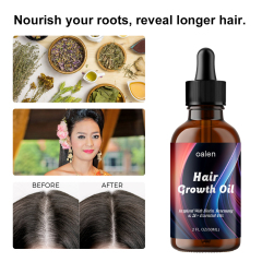 OEM Natural Herbal Rosemary Castor Anti-hair Loss Hair Lotion Pure Plant Scalp Treatment Essential Oil Hair Growth Oil,oalen cosmetics