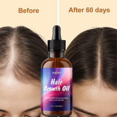 Private Label 100% Natural Organic Herbal Hair Growth Oil Serum Rosemary Castor Scalp Strengthening 60ml,MY SHOP