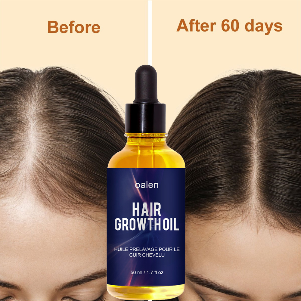 50ml Natural Organic Herbal Hair Growth Oil Serum Rosemary Castor Scalp Strengthening,oalen cosmetics