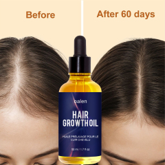 50ml Natural Organic Herbal Hair Growth Oil Serum Rosemary Castor Scalp Strengthening,oalen cosmetics
