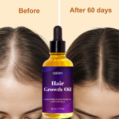 Organic Repair Serum Scalp Massage Hair Growth Oil Anti Hair Loss Keratin Rosemary Oil Hair Treatment,MY SHOP
