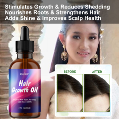 Private Label 100% Natural Organic Herbal Hair Growth Oil Serum Rosemary Castor Scalp Strengthening 60ml,MY SHOP