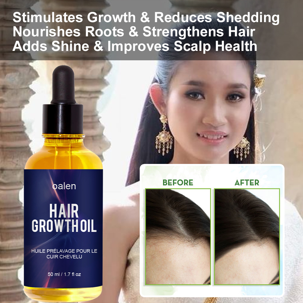 50ml Natural Organic Herbal Hair Growth Oil Serum Rosemary Castor Scalp Strengthening,oalen cosmetics