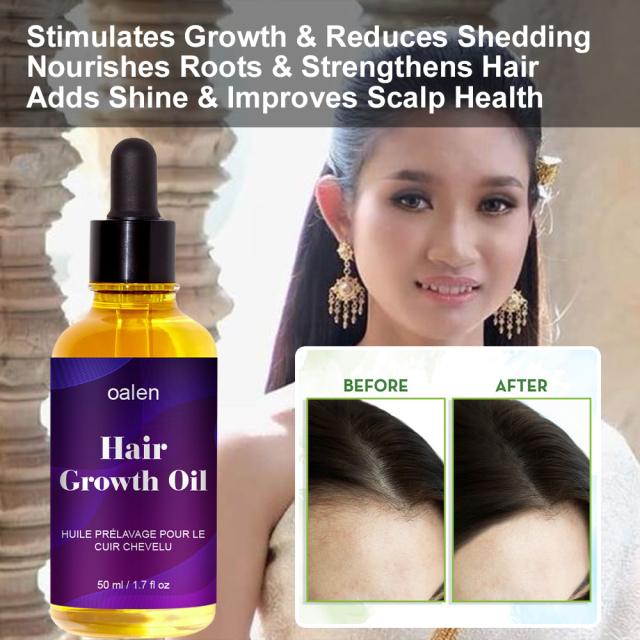 Organic Repair Serum Scalp Massage Hair Growth Oil Anti Hair Loss Keratin Rosemary Oil Hair Treatment,MY SHOP