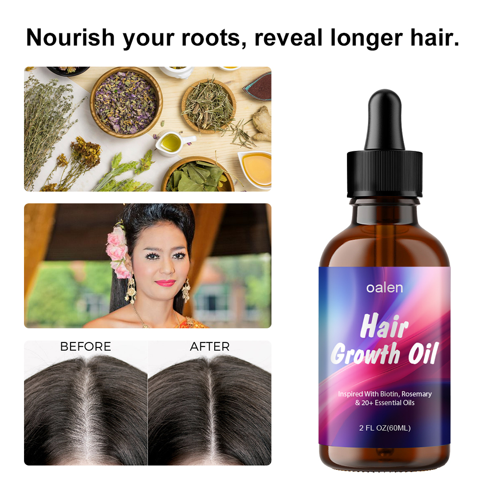 Private Label 100% Natural Organic Herbal Hair Growth Oil Serum Rosemary Castor Scalp Strengthening 60ml,MY SHOP