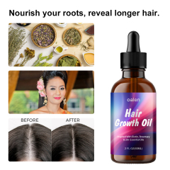 Private Label 100% Natural Organic Herbal Hair Growth Oil Serum Rosemary Castor Scalp Strengthening 60ml,MY SHOP